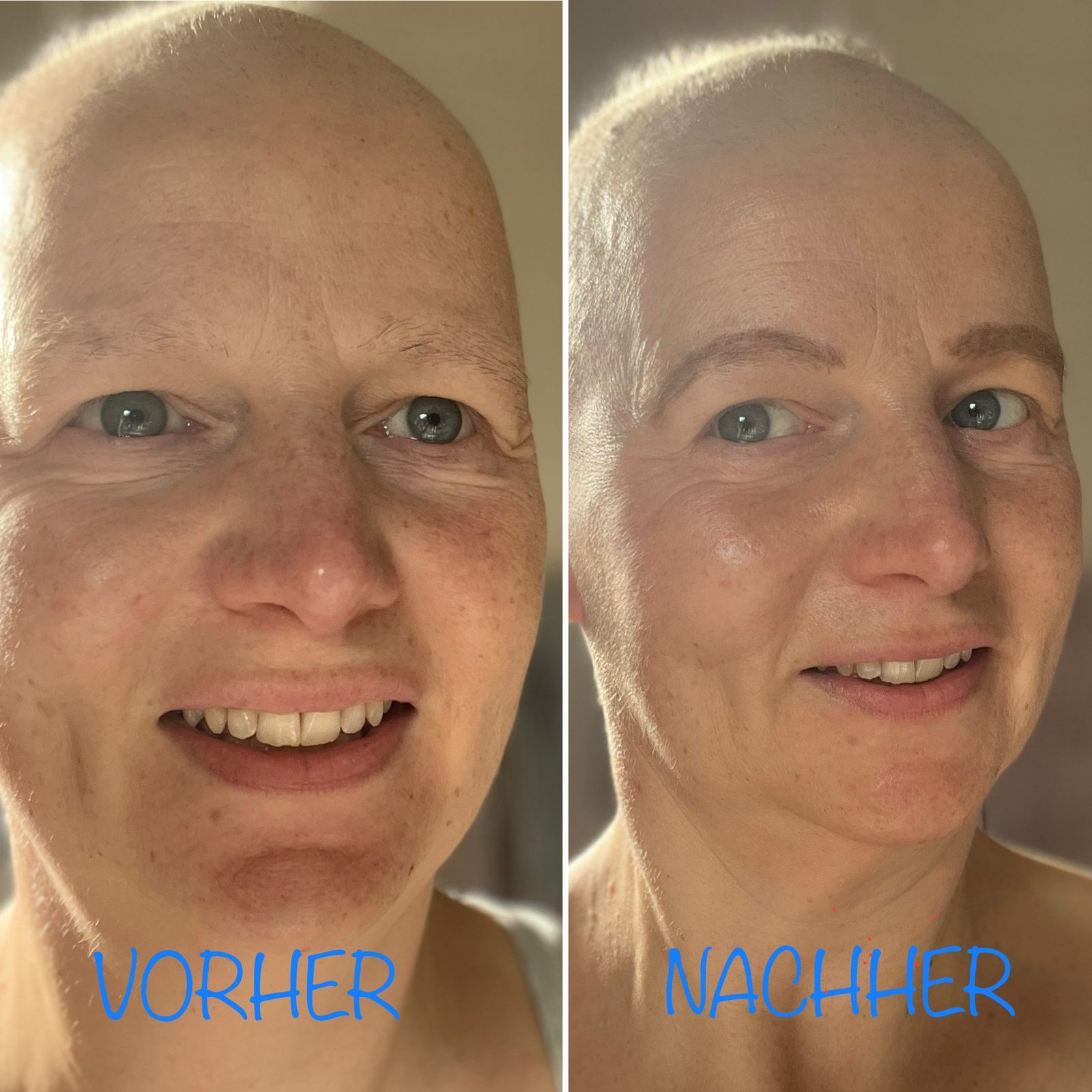 12 von 12 am Chemotherapie-Tag, Bild 2 von 12: Augenbrauen