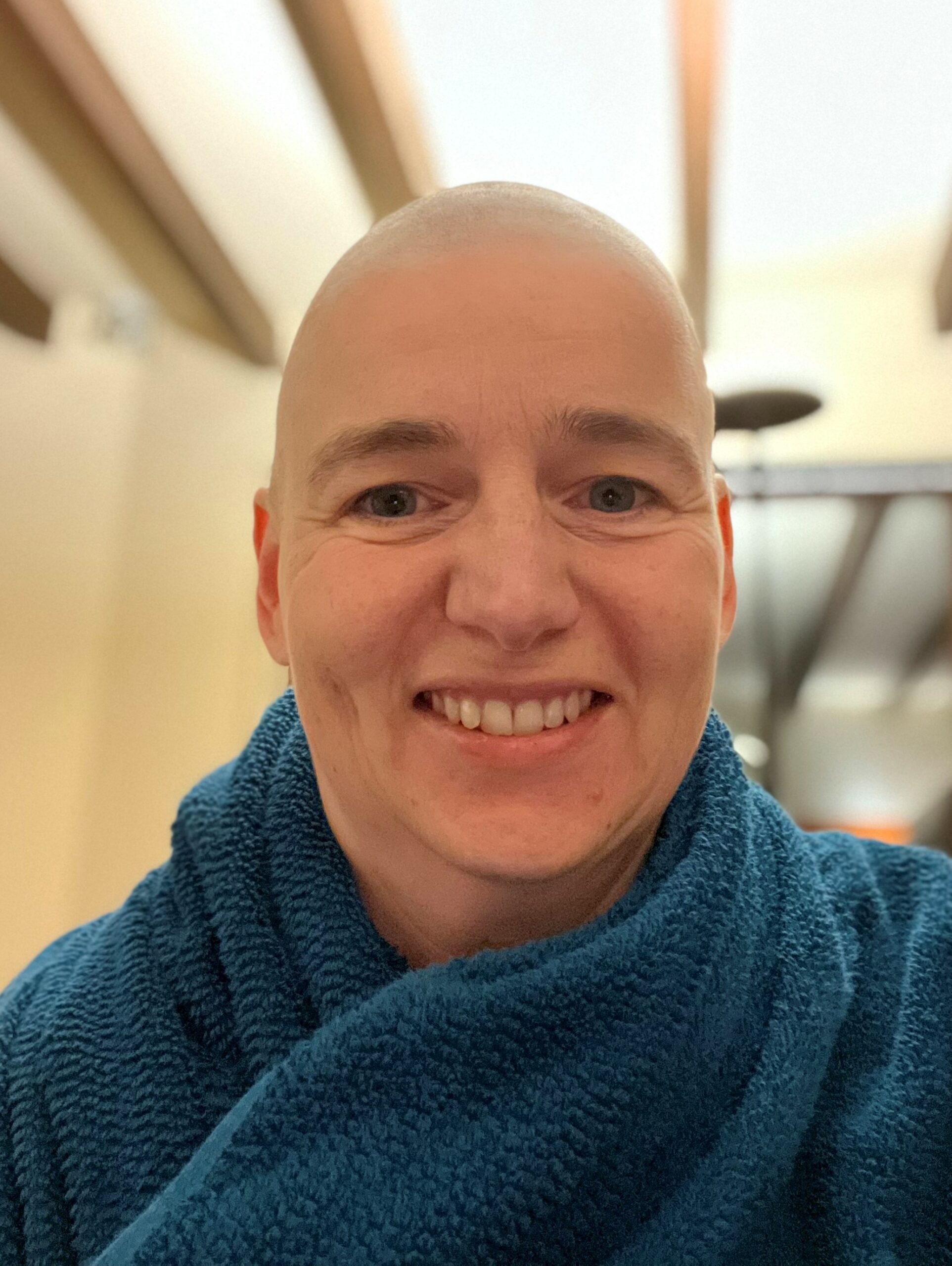 Chemotherapie: Haare ab, Glatze