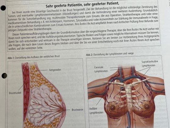 Aufklärungsbogen zur Strahlentherapie bei Brustkrebs