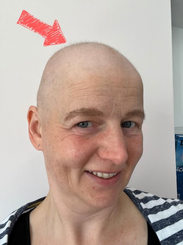 Die Haare kommen zurück