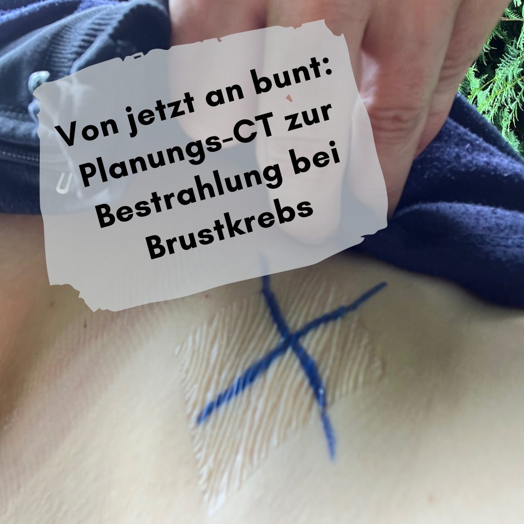 Von jetzt an bunt: Planungs-CT zur Bestrahlung bei Brustkrebs