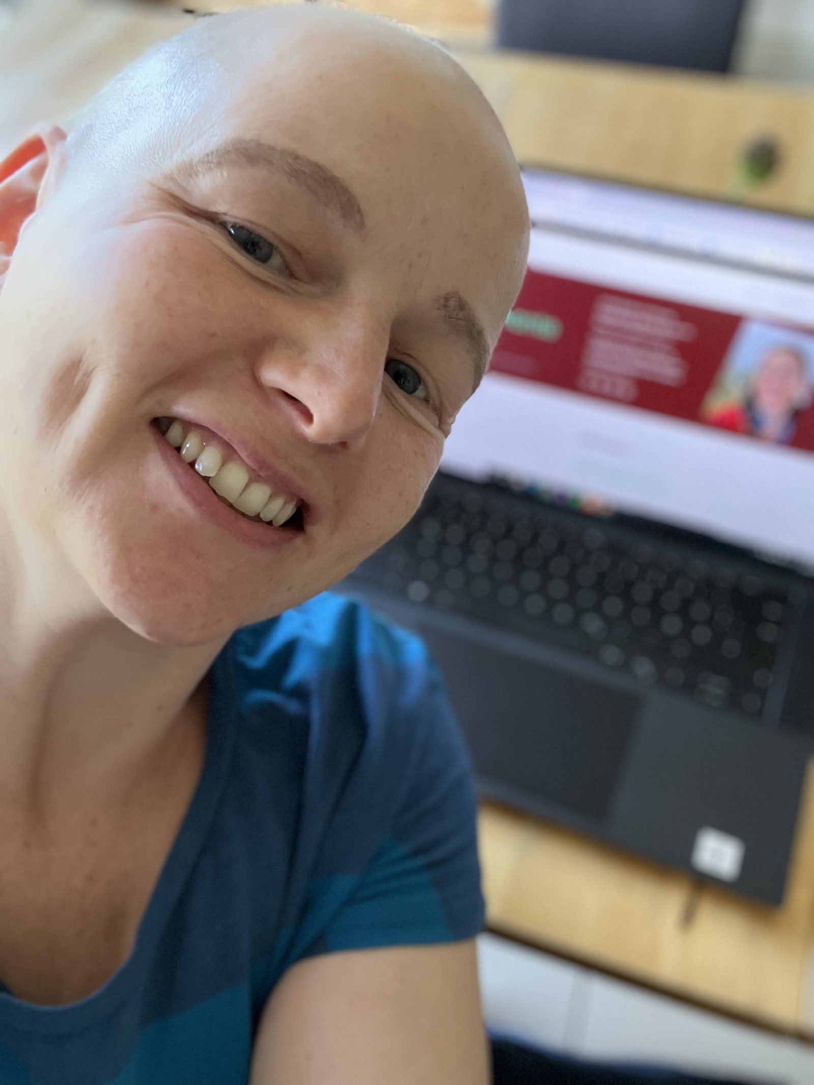 Meine ungeplante Reise - Diagnose Brustkrebs